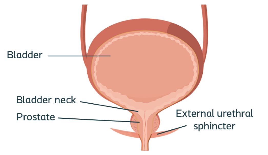 Prostate Map Bladder Prostate Cancer & Stress Urinary Incontinence (SUI)