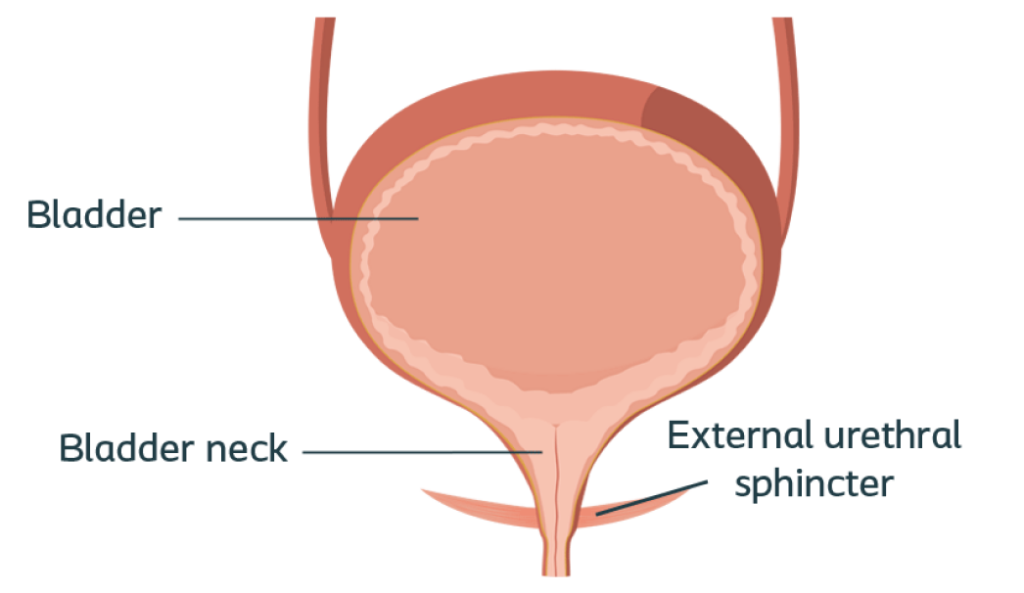 cpmh_sui_post-prostatectomy