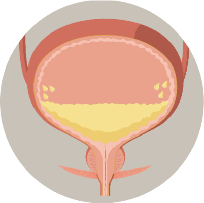 cpmh_sui_urinary-system_1