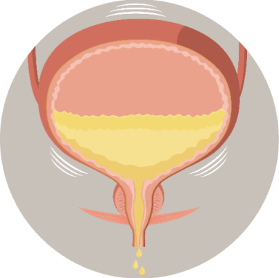 cpmh_sui_urinary-system_3