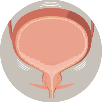 cpmh_sui_urinary-system_4